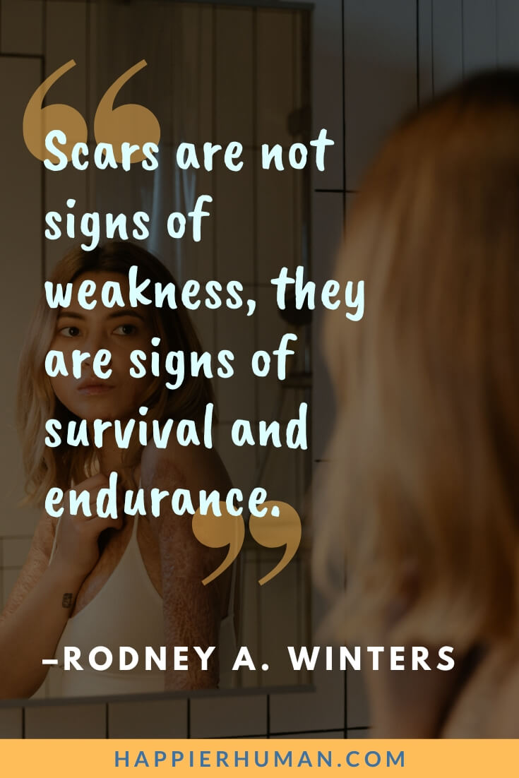 Survival Quotes - “Scars are not signs of weakness, they are signs of survival and endurance.” - Rodney A. Winters | survival quotes funny | survival quotes in the hunger games | survival quotes images